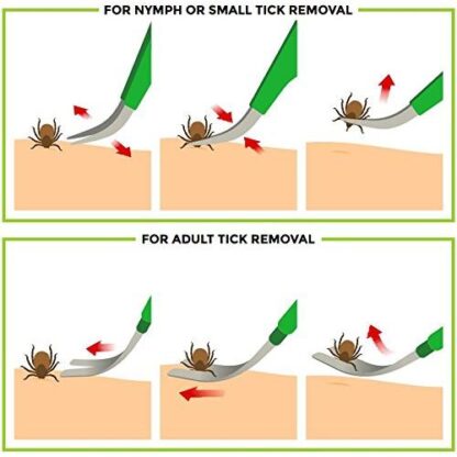 TickCheck Premium Tick Remover Kit - Stainless Steel Tick Remover